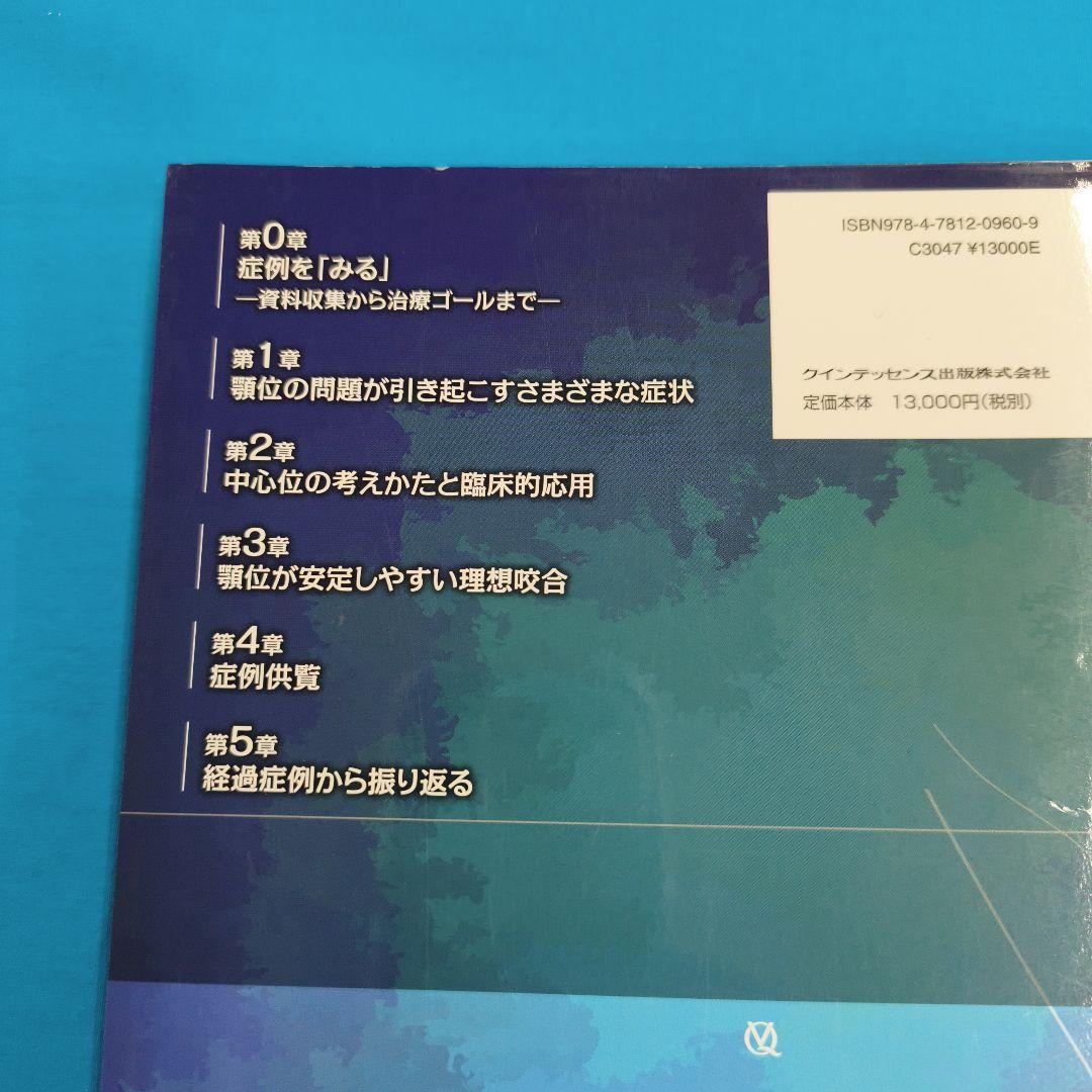 ●裁断済 その下顎位をどう決める？